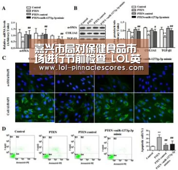 LOL英雄联盟投注 