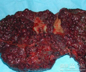 LOL英雄联盟投注 